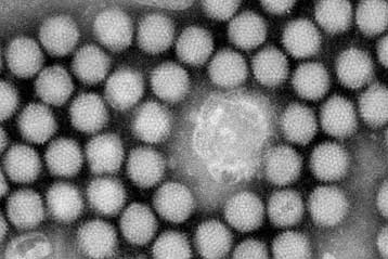 Επικίνδυνη μορφή κρυολογήματος αναγνωρίστηκε στις ΗΠΑ