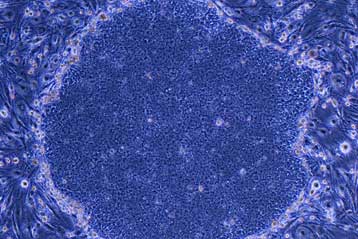 Εμβρυικά βλαστικά κύτταρα τώρα και χωρίς χρήση εμβρύων