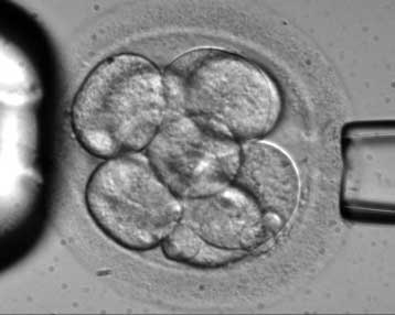 Σύσταση εταιρείας βλαστοκυττάρων στην Ελλάδα από τις Stem-Health και Μητέρα ΑΕ