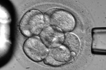 Ανθρώπινα έμβρυα δημιουργήθηκαν με κλωνοποίηση ενηλίκων