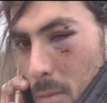 Εξάμηνη ποινή φυλάκισης στον Μουνούα της Λα Κορούνια επειδή χτύπησε συμπαίκτη του