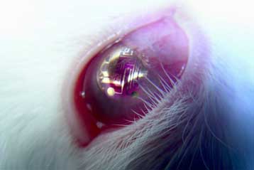 Ηλεκτρονικοί φακοί επαφής προσφέρουν υπερανθρώπινη όραση