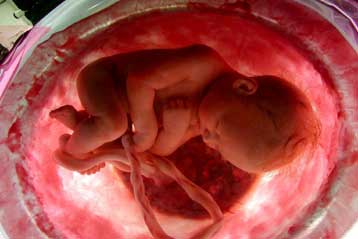 Γονίδια και περιβάλλον αλληλεπιδρούν στις ψυχικές ασθένειες