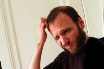 Γονίδια της κληρονομικής φαλάκρας στόχος για νέες θεραπείες