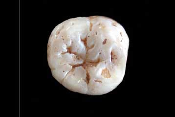 Ένα δόντι από το Γύθειο αποκαλύπτει τις μετακινήσεις των Νεάντερταλ