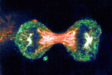 Σημαντικό ένζυμο στόχος για νέες αντικαρκινικές θεραπείες