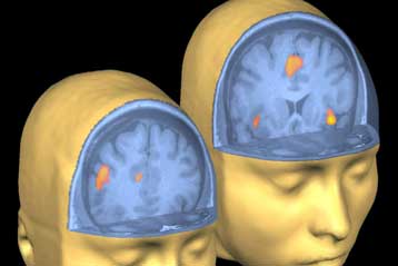 Σύστημα τομογραφίας «βλέπει» μέσα από τα μάτια του εξεταζόμενου