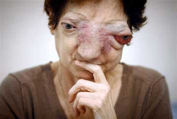 Πέθανε η Γαλλίδα στην οποία η Δικαιοσύνη αρνήθηκε την ευθανασία