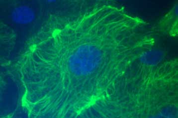 Ερευνητικό πρόγραμμα για την αναγέννηση ιστών ξεκινά το Πεντάγωνο