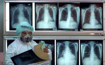 Σε χρόνιες παθήσεις αποδίδονται πλέον οι περισσότεροι θάνατοι παγκοσμίως