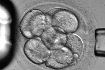 «Ναι» στα υβριδικά έμβρυα ανθρώπων-ζώων ψήφισαν οι Βρετανοί βουλευτές