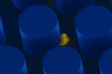 Πρωτοποριακή τεχνολογία παρακολουθεί ζωντανά την εξέλιξη του καρκίνου