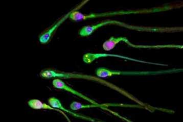 Η ανδρική γονιμότητα φθίνει μετά την ηλικία των 35