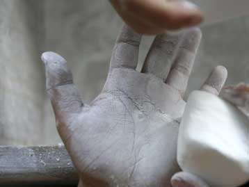 Πραγματοποιήθηκε η πρώτη διπλή μεταμόσχευση χεριών στη Γερμανία