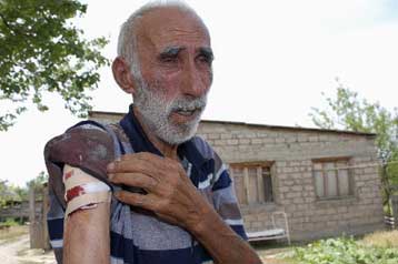 Αυτοσυγκράτηση ζητά το ΝΑΤΟ μπροστά στην κλιμάκωση στη Νότιο Οσετία