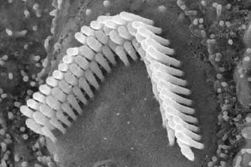 Γονιδιακή θεραπεία ίσως επιτρέψει θεραπεία της κώφωσης