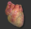 Ένζυμο παρέχει προστασία έναντι της καρδιακής βλάβης που προκαλεί το έμφραγμα