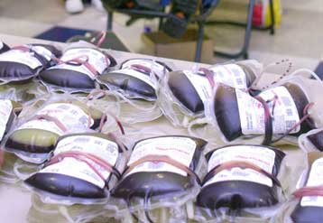 Θετική στον ιό HIV, αλλά όχι μέσω μετάγγισης η 70χρονη