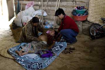 «Κραυγαλέες ανισότητες» στην ιατρική περίθαλψη καταγγέλλει ο ΟΗΕ