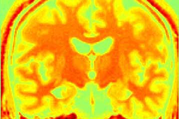 Λεπτή η γραμμή ανάμεσα στην αγάπη και το μίσος