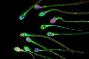 Οι έξυπνοι άνδρες «έχουν και καλύτερο σπέρμα»