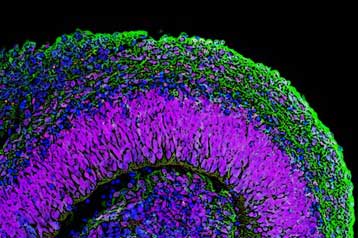 Εγκεφαλικός ιστός καλλιεργήθηκε από ανθρώπινα βλαστικά κύτταρα