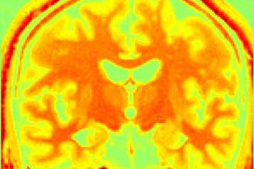 Βρετανίδα δεν αναγνωρίζει καμιά φωνή εκτός του Σον Κόνερι