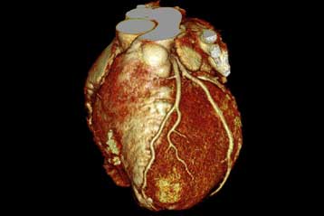 Ελπιδοφόρος η πρώτη γονιδιακή θεραπεία για την καρδιακή ανεπάρκεια