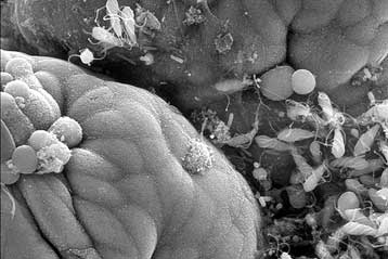 «Τροπικό δάσος» μικροβίων ζει και βασιλεύει στο ανθρώπινο έντερο