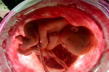 Προγεννητικός έλεγχος τώρα και στο αίμα της εγκύου