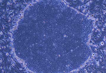 Ο «αναπρογραμματισμός» των κυττάρων κορυφαίο επίτευγμα του 2008