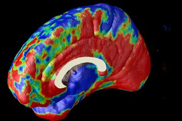 Τομογράφος αρχίζει να εισβάλλει σε φαντασίες και όνειρα