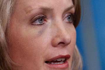 Διχάζουν το Ιράκ τα δημοσιογραφικά παπούτσια, πάντως ο Μπους δεν κρατά… κακία