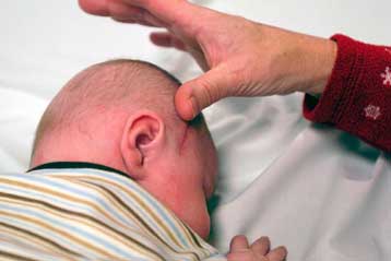 Βρέφος γεννήθηκε με ένα… πόδι μέσα στον εγκέφαλο