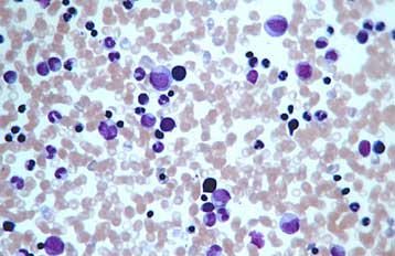 Ο πρώτος τεχνητός μυελός των οστών ζει στο δοκιμαστικό σωλήνα