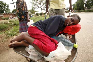 Μεγάλο άλμα στους θανάτους από χολέρα στη Ζιμπάμπουε διαπιστώνει ο ΠΟΥ