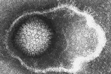 Πειραματική κρέμα προλαμβάνει και καταπολεμά τον έρπητα