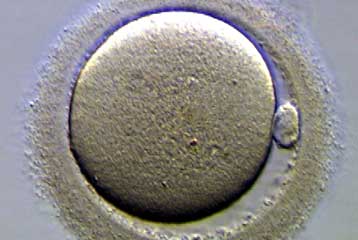 Προηγμένο λογισμικό αυξάνει την αποτελεσματικότητα της εξωσωματικής