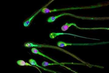 Βρετανίδα θα αποκτήσει παιδί από το σπέρμα του νεκρού συζύγου της