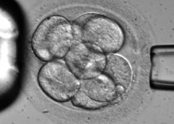 Απέτυχαν οι πρώτες δοκιμές σε υβριδικά έμβρυα ανθρώπου-ζώων