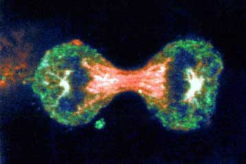 Ένζυμο της μετάστασης ίσως γίνει στόχος για νέες αντικαρκινικές θεραπείες