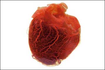 Ανακαλύφθηκε γονίδιο που ευθύνεται για αιφνίδιο καρδιακό θάνατο