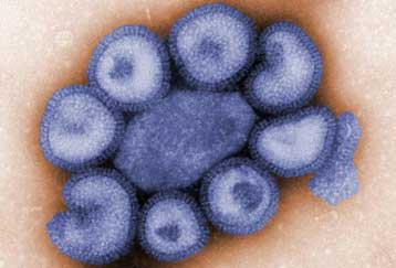 Στους έξι μήνες υπολογίζεται ο χρόνος παρασκευής εμβολίων για τη γρίπη των χοίρων