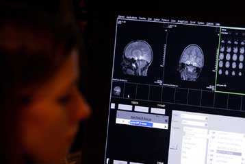 Συγκρατημένη αισιοδοξία για πειραματικό φάρμακο κατά της νόσου Αλτσχάιμερ