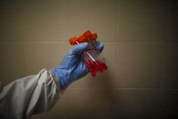 Πρώτη δοκιμή για την παραγωγή αντισωμάτων κατά της νέας γρίπης