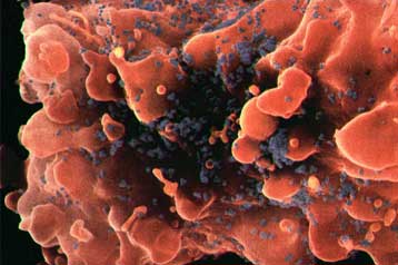 Γενετικά τροποποιημένος ιός ίσως προσφέρει ανοσία στο AIDS