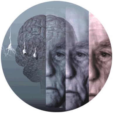 Ποια είναι τα συμπτώματα της νόσου Αλτσχάιμερ;