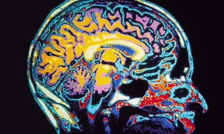 Είναι δυνατή η ακριβής διάγνωση της νόσου Αλτσχάιμερ;