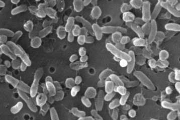 Βακτήριο ξυπνά έπειτα από 120.000 χρόνια στην κατάψυξη