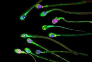 Το καθημερινό σεξ «βελτιώνει την ποιότητα του σπέρματος»